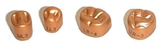 Gold Anodized Crowns - 2nd Molar