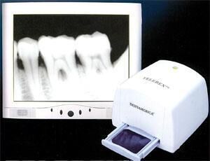 Telerex Video X-Ray Film Viewer - Dentamerica