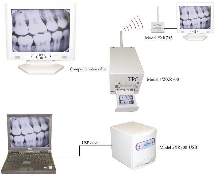 X-ray Film Reader- TPC
